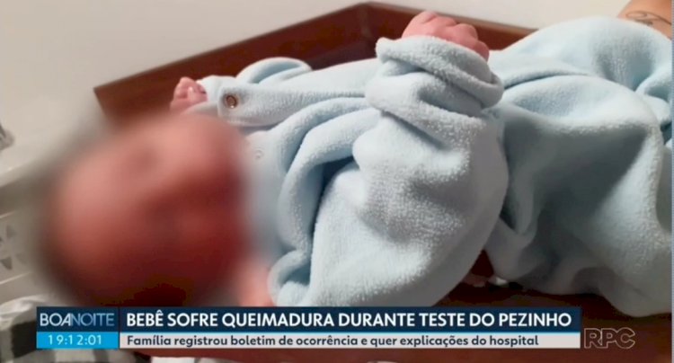 Hospital e Conselho de Enfermagem apuram caso de bebê que teria sofrido queimadura durante teste do pezinho